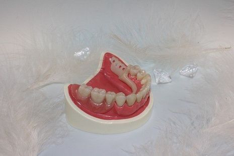 Abbildung 1: Eine Zahnzusatzversicherung sollte auch nach ihren Serviceleistungen ausgewählt werden. Bildquelle: @ dental-inno / Pixabay.com