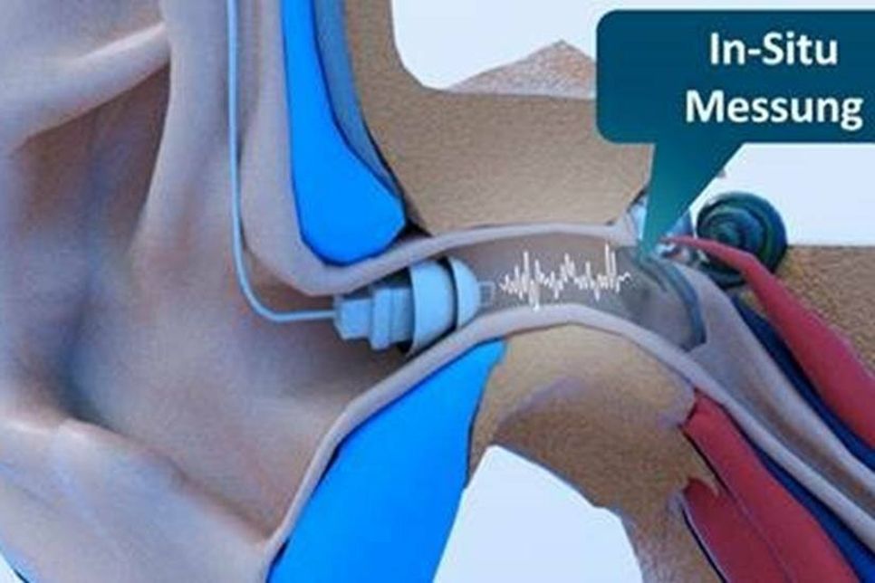 Natürliches Hören mit Hörsystemen ist möglich – Dank neuesten In-Situ-Messverfahren und der Hörmanufaktur.