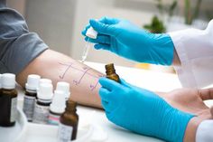 Eine beginnende Pollenallergie sollte frühzeitig erkannt und behandelt werden: Ein Prick-Test kann zu einer gesicherten Diagnose führen. Foto: AOK/hfr.