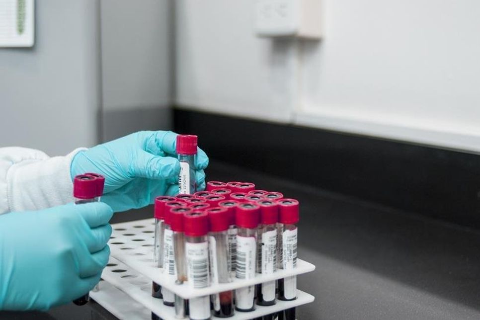 Nach den Plänen der Landesregierung sollen sich künftig alle Einreisenden aus Risikogebieten auf das Coronavirus testen lassen.