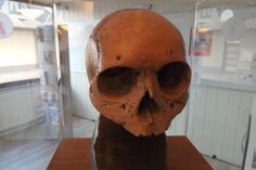 Der Schädel gilt als der älteste bislang gefundene Schädel aus Norddeutschland und Skandinavien.